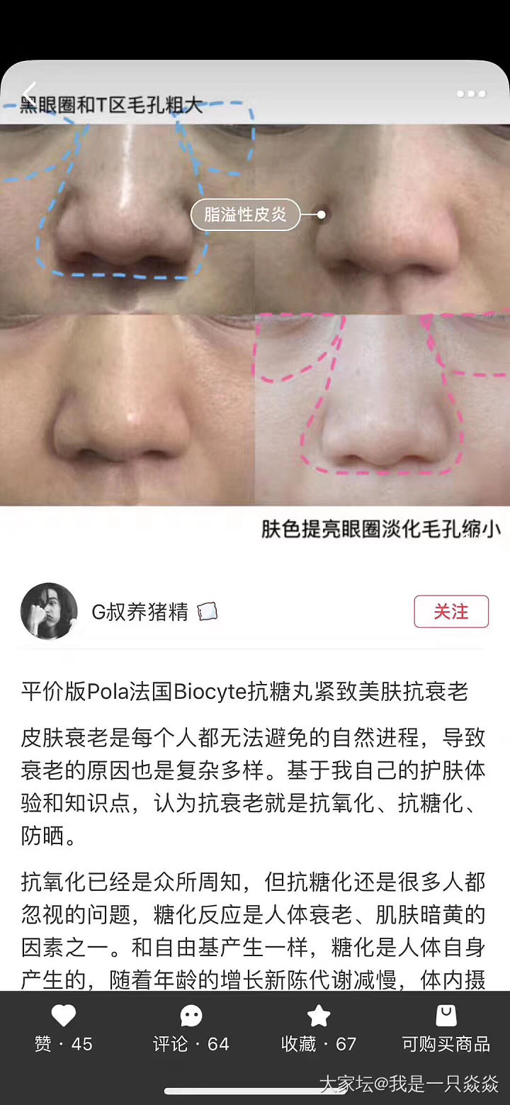 想知道抗糖丸有用吗？_护肤