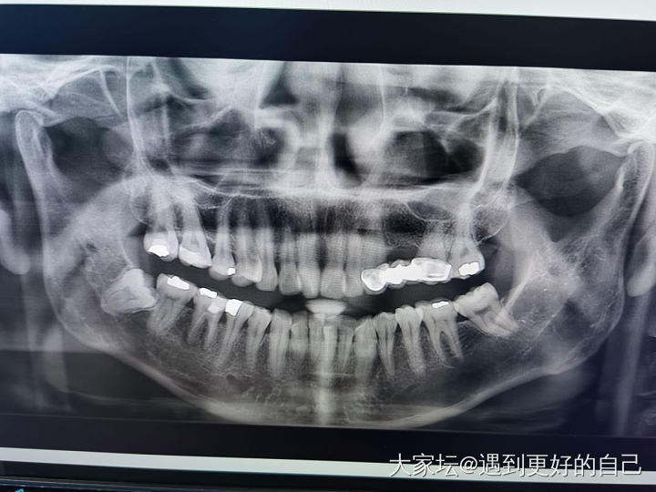 36岁的我萌生了矫牙的念头_闲聊