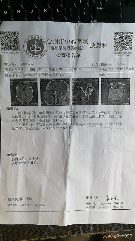 请坛里的医生帮帮忙 感恩_健康