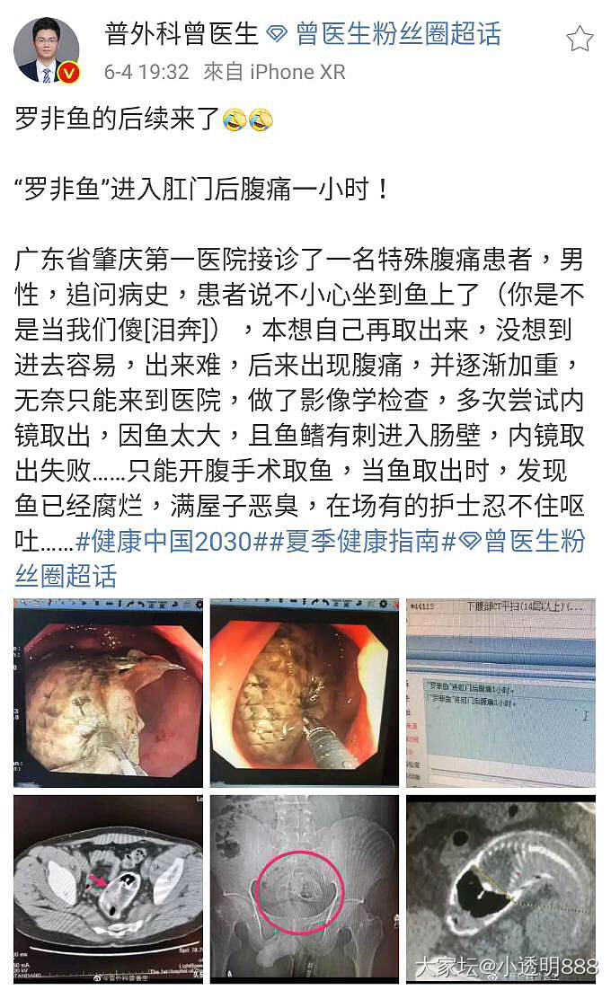 笑死我了，男人开发身体的行动力这么强的吗（这是一个疼痛的贴，共情能力强的慎入）_两性贴图