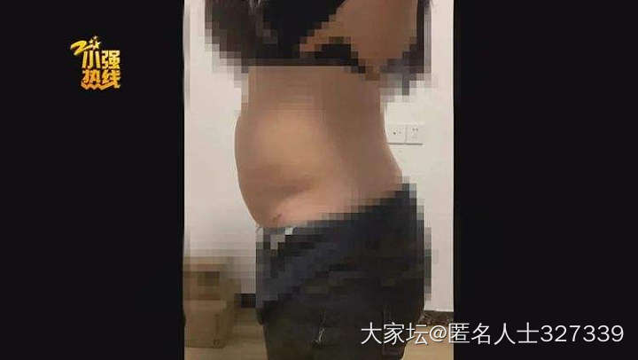 70公斤的浙江姑娘认为抽脂减肥无效要求退款。_贴图减肥
