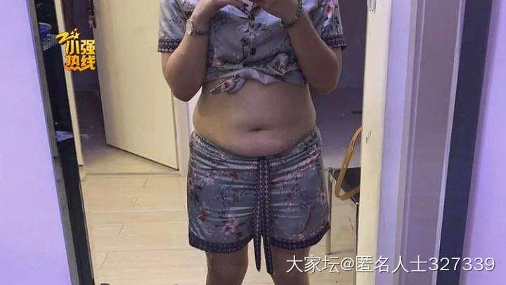 70公斤的浙江姑娘认为抽脂减肥无效要求退款。_贴图减肥