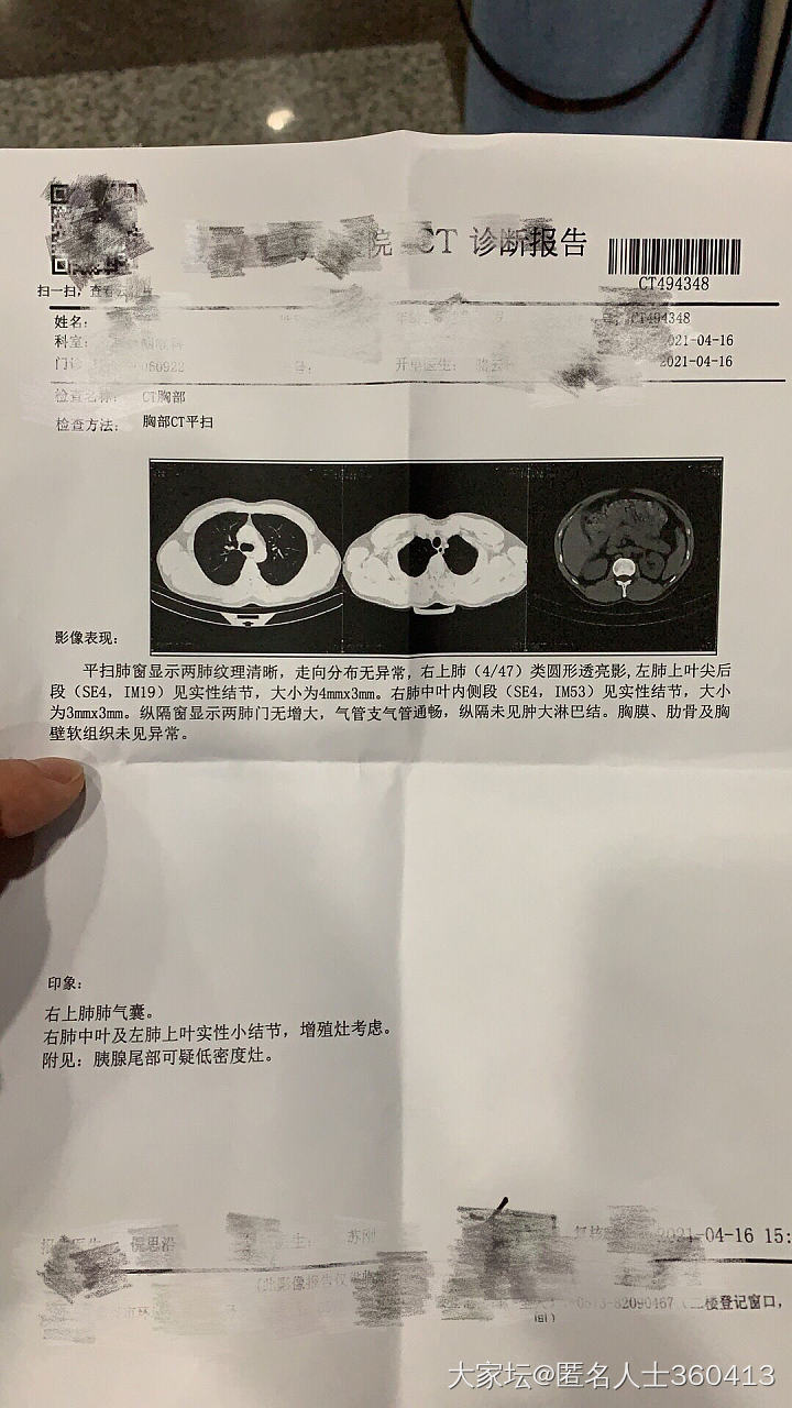 CT报告_健康