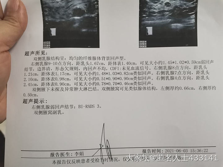 乳房囊性结节3级_健康