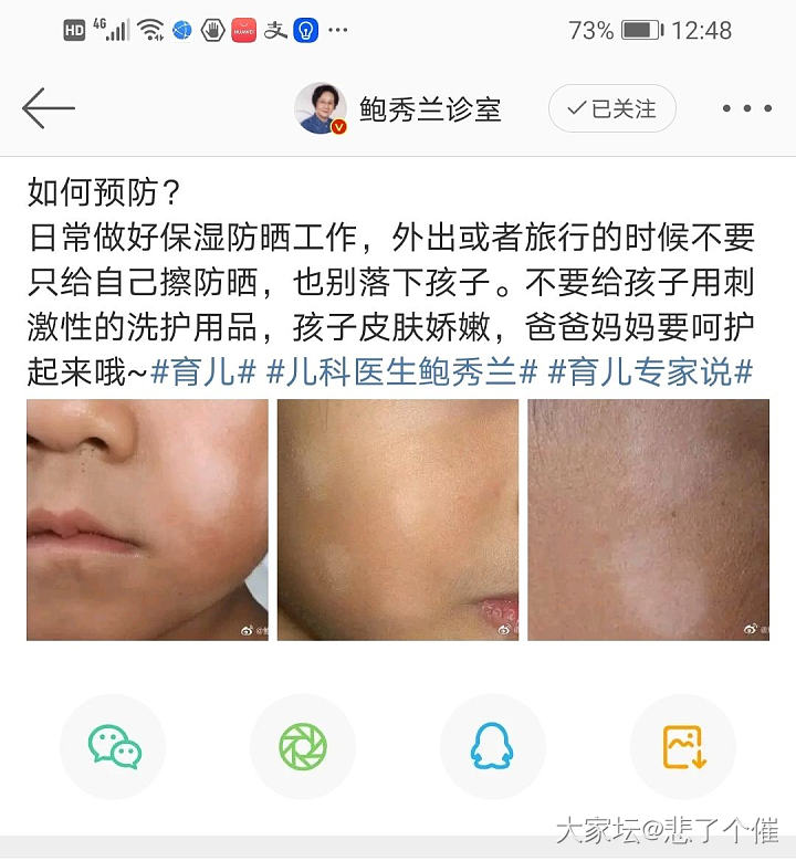 女儿4岁半了 腿上出现一些白斑！_健康