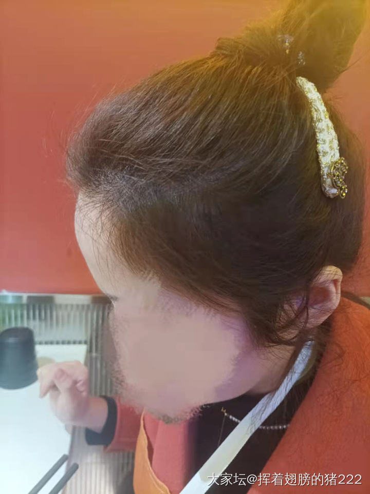 关于胖子和秃子这件事