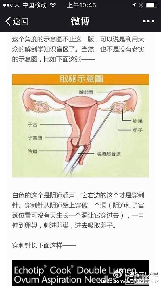 有人做过人工授精或者试管婴儿吗？_准备怀孕