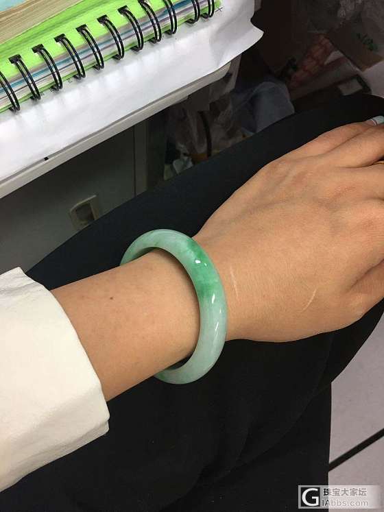 收了一只镯子，挡着手上的疤_手镯翡翠