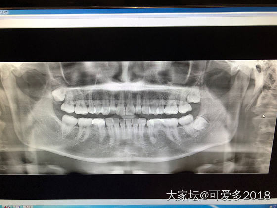 请教一下_健康