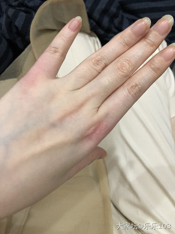 新到手的冰绿小贵妃，干撸戴不上，要涂润肤霜，留不留呢？实物如图，完全无P，准确的..._手镯翡翠