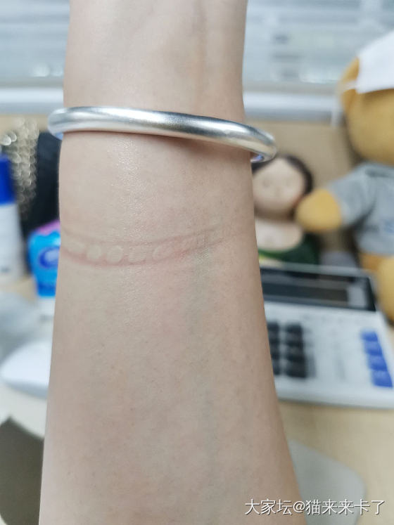 窄囍福咬的蚊子包~_银