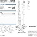 20131105-顶级圆钻2.01 DIF 3EX GIA N GIA权威认...