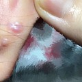 炎炎夏日被疯狗咬了,请它不要再艾特我了