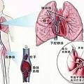 输液瓶里打脏水 熊孩子模仿医生动作害奶奶住进ICU