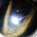 咱的藏品 最大的金绿猫眼宝石276克 1380克拉 经专家鉴定