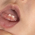 八个月的宝宝牙龈上有黑点
