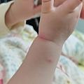 求推荐宝宝用的驱蚊液和手环之类的，大人用的也推荐个吧？