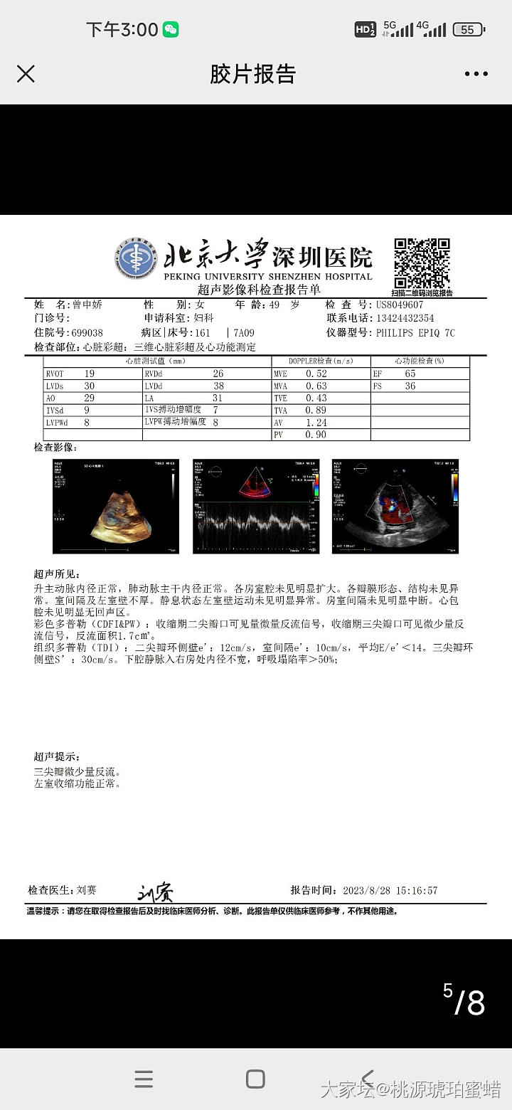 卵巢癌症晚期还有救吗_健康