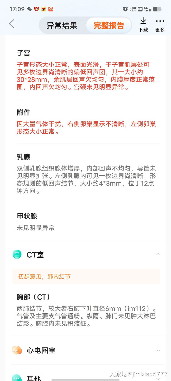 CT出来了 磨玻璃结节6毫米了 吓人_健康