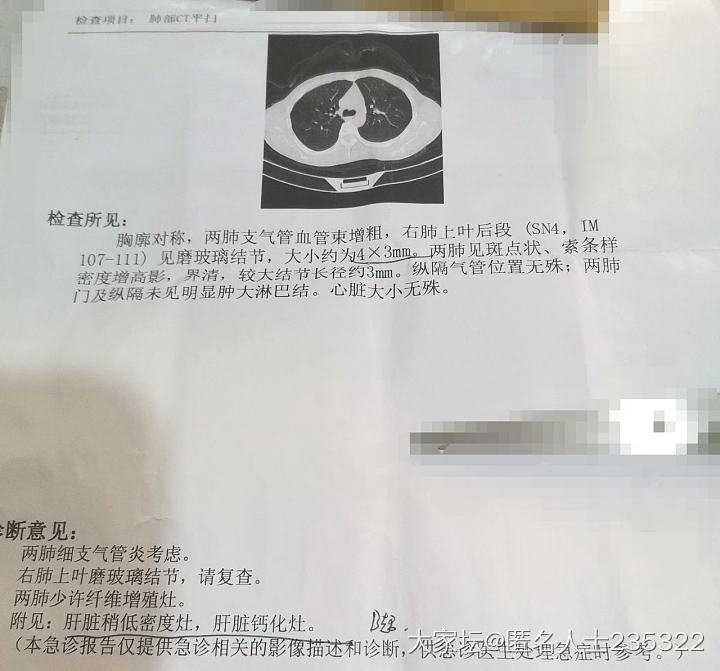 问一下坛友们，应该挂什么科？_健康