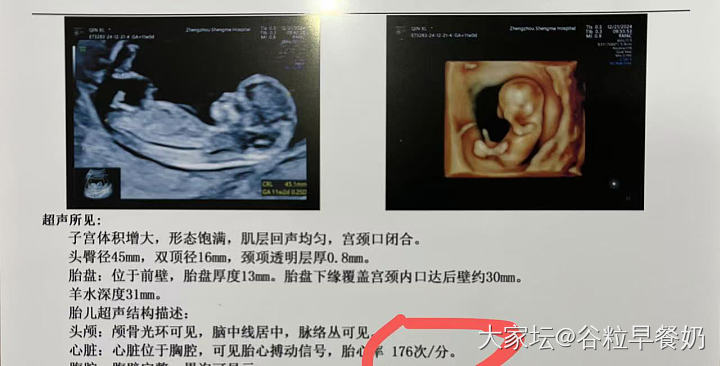 大家看看是弟弟还是妹妹呀？_生孕