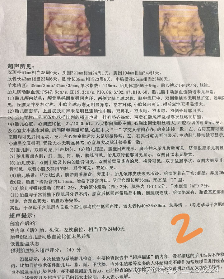 四维猜蓝粉_生孕