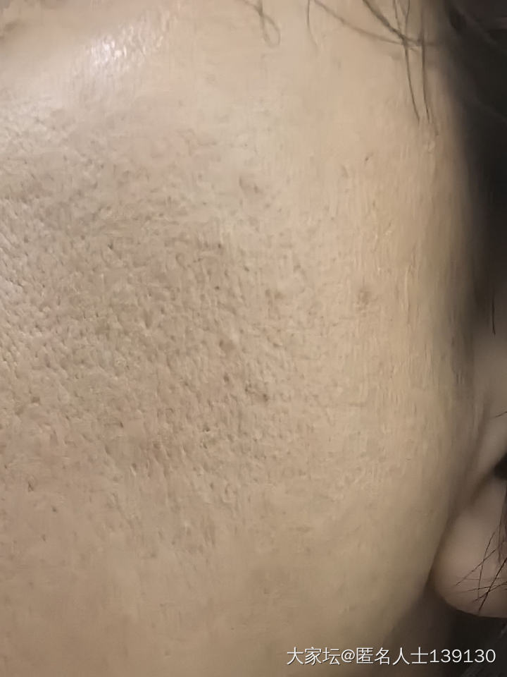 分享给大家一个很好用的家庭护理皮肤的经验_护肤