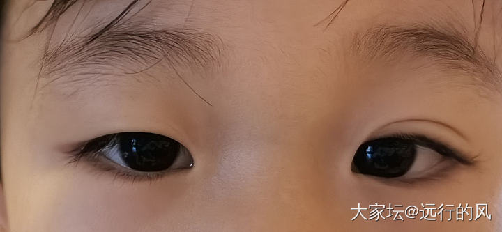 小孩子怎么弄成双眼皮_育教亲子生活