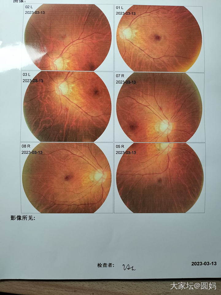哪吒害我😂_健康生活