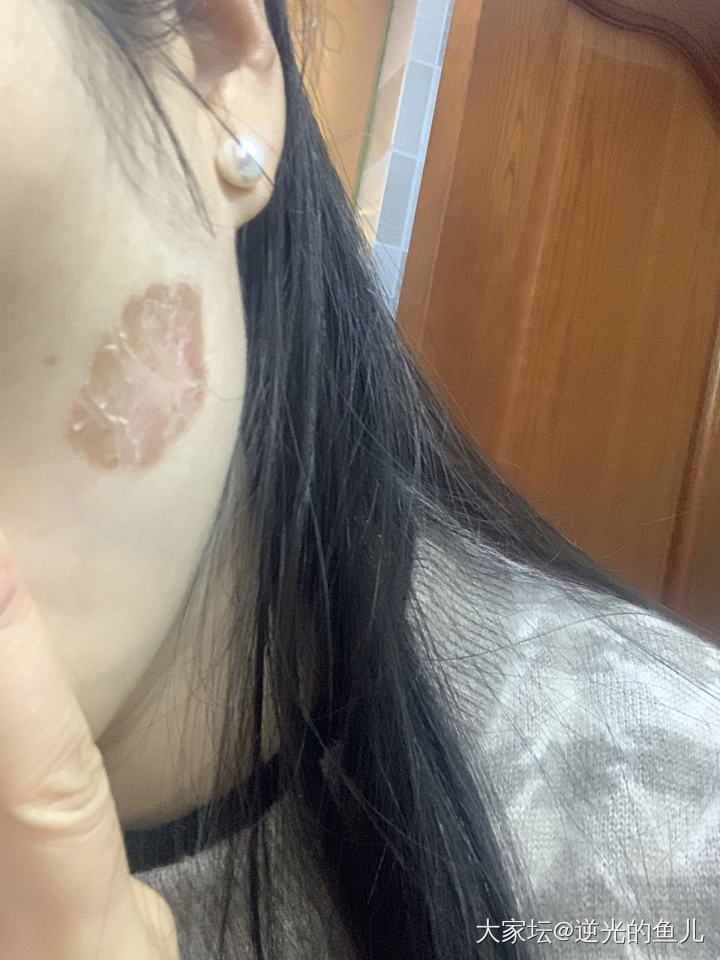 限时“花千骨”毁容版_健康