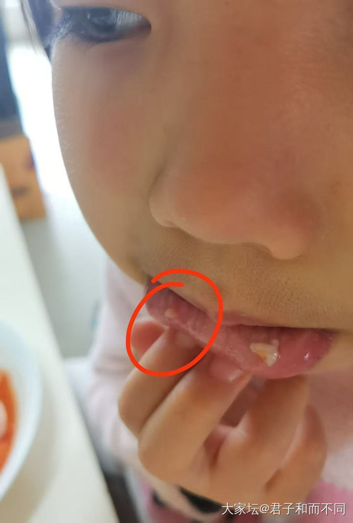 😆😆小妞又长个囊肿_健康育教亲子