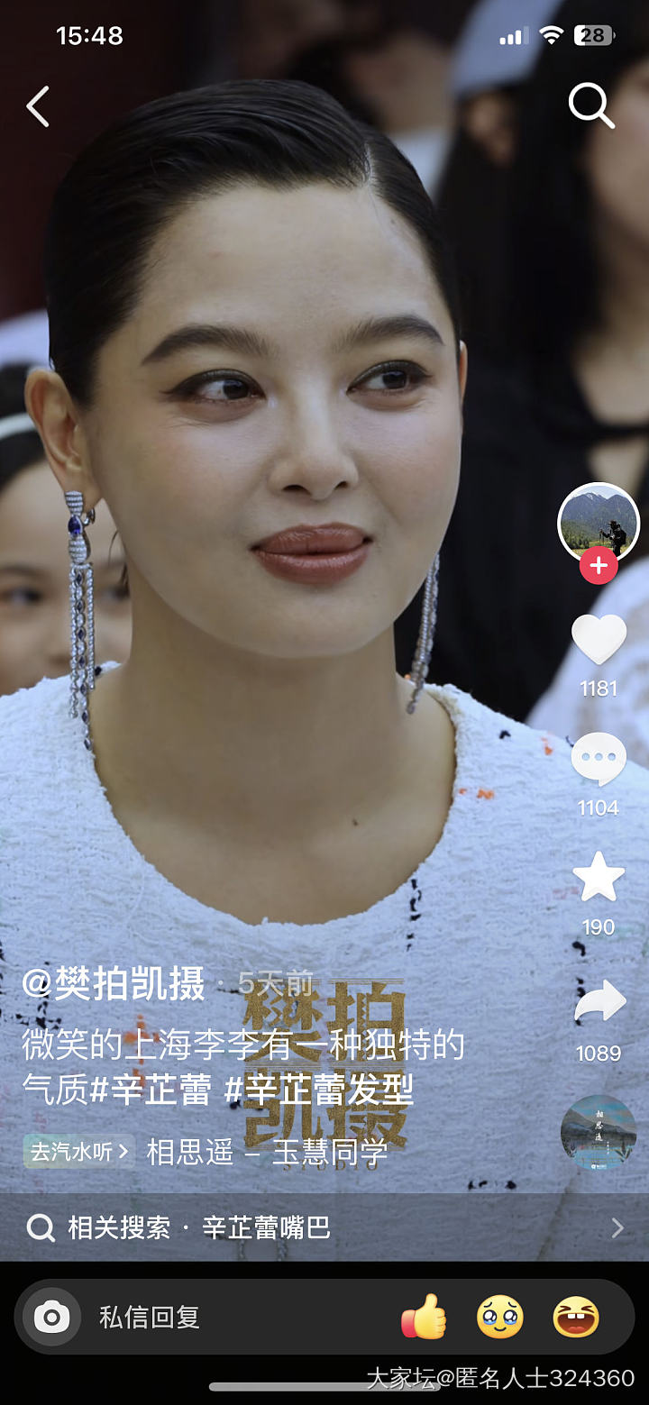 这个嘴唇是天生的吗_娱乐八卦