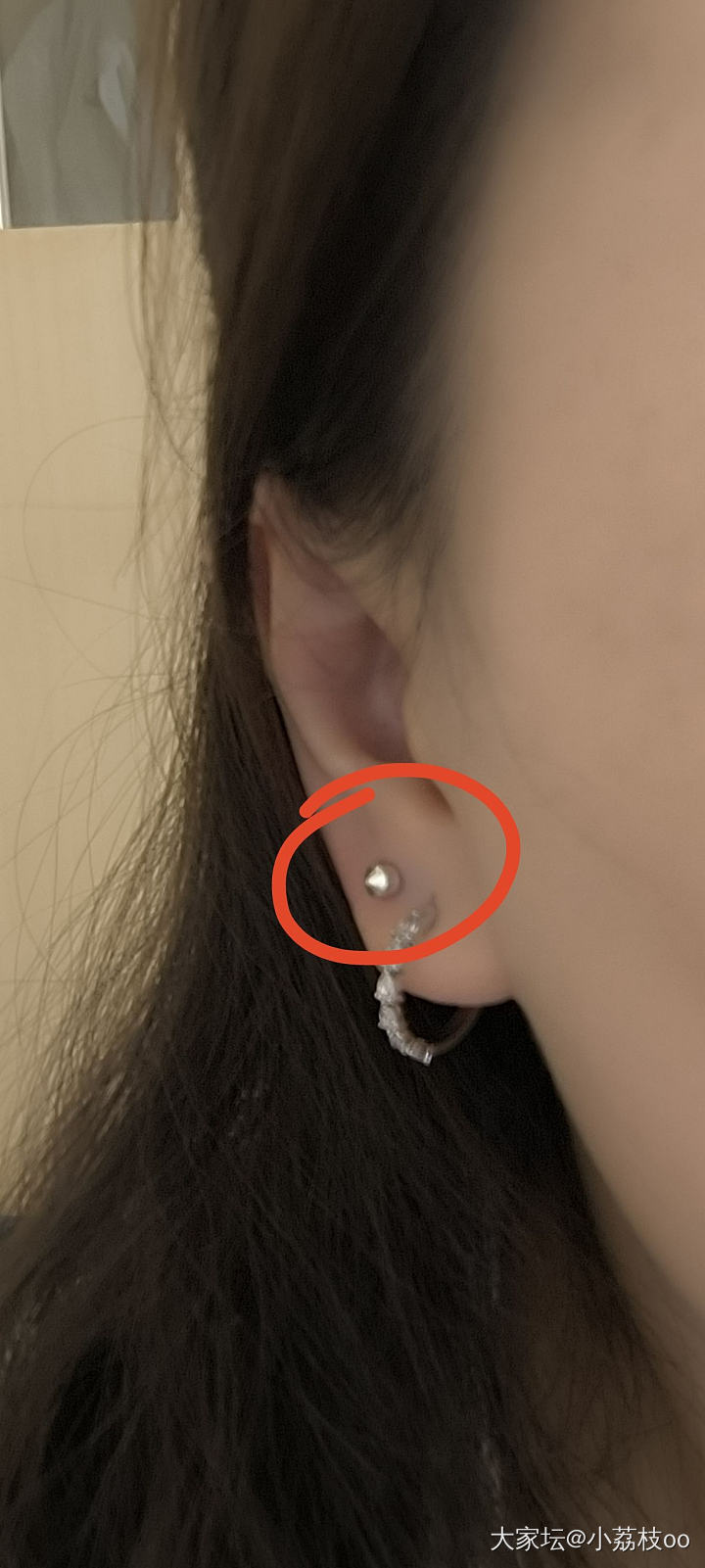 枪打的新耳洞第4天，能换新耳钉吗？_健康
