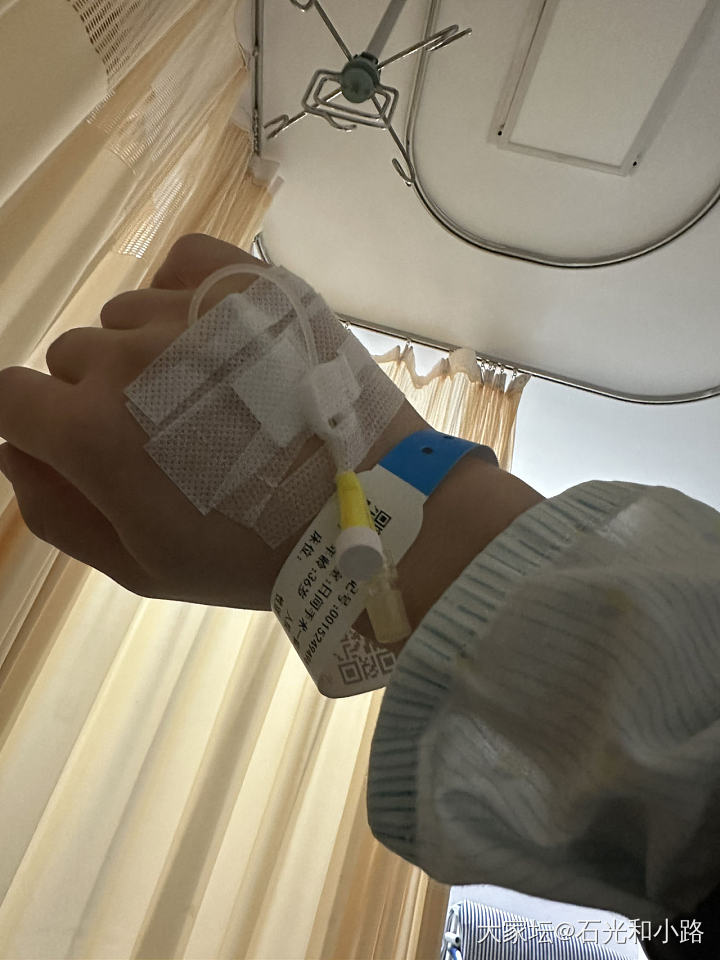 最终选择了介入硬化治疗_健康