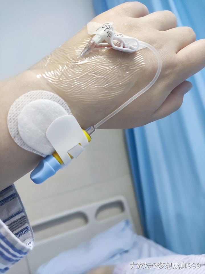 最终选择了介入硬化治疗_健康