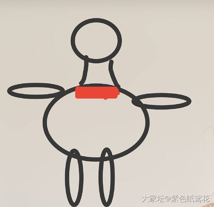 悲伤一刻：百密一疏的晒伤。_闲聊