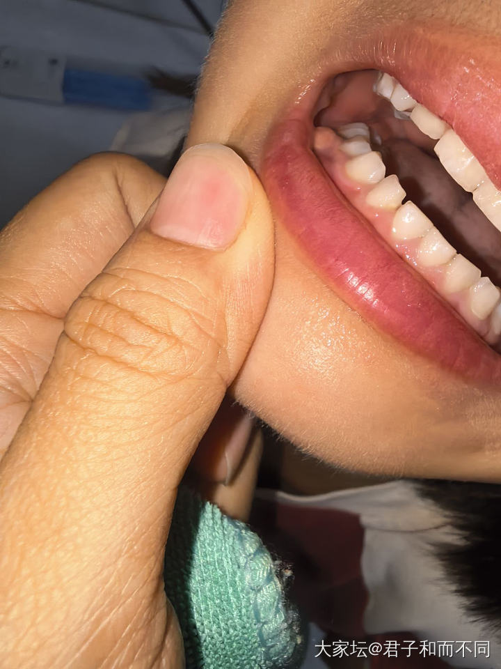 不快乐了，小妞牙又有问题了😆😆_育教亲子健康