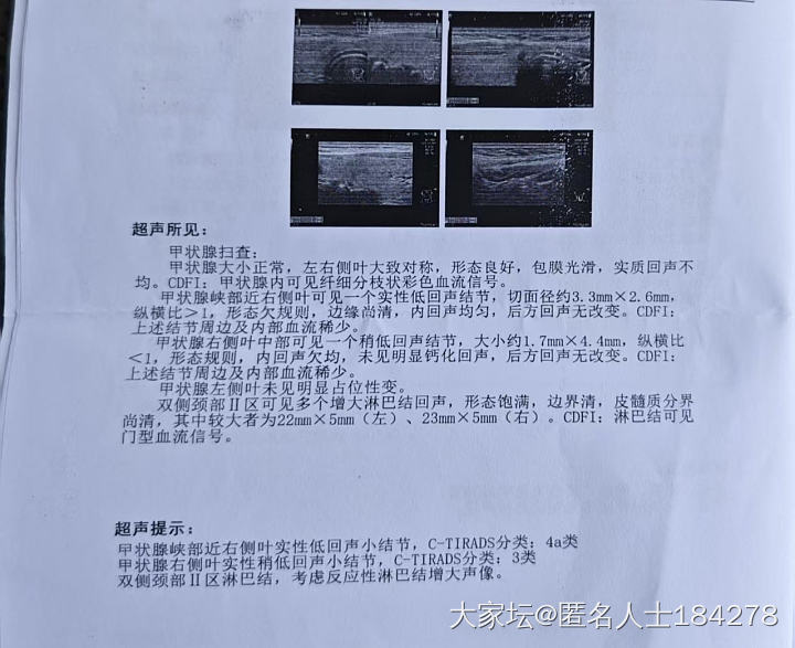 姐妹们，有懂甲状腺，乳腺，肺结节的帮看看吗？_健康