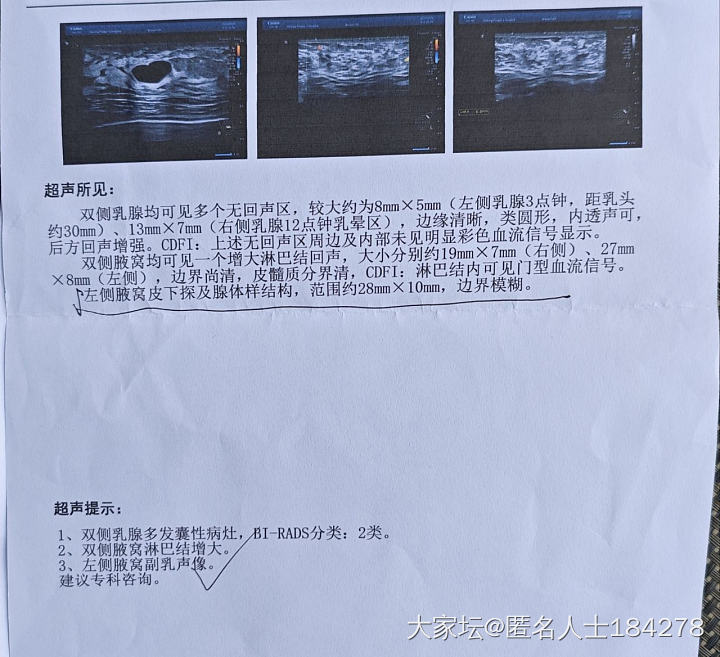 姐妹们，有懂甲状腺，乳腺，肺结节的帮看看吗？_健康