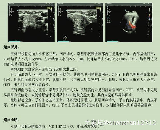 甲状腺结节长势很快_健康