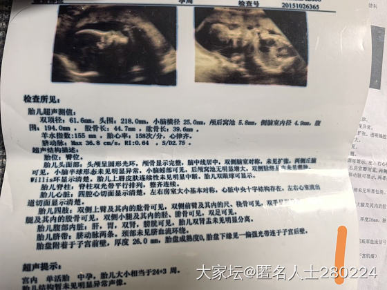 四维猜蓝粉_生孕