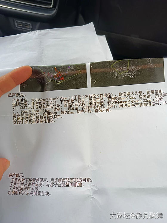 有会看的吗？医生说没多大问题，吃了一次醋酸甲羚孕酮片，来了一次月经，量很大，说来..._健康