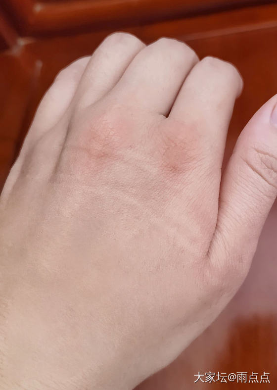 为了戴上捡的漏也是拼了_玉髓玛瑙
