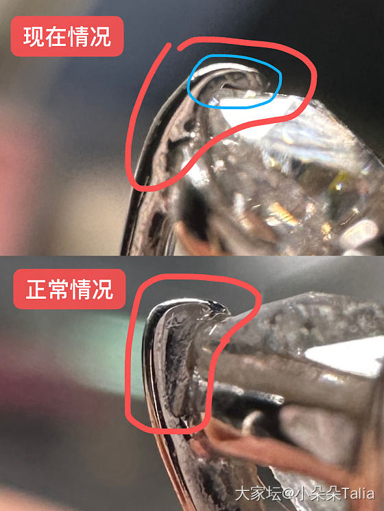 求助｜镶嵌改了三次，越改越差怎么办？听劝_镶嵌