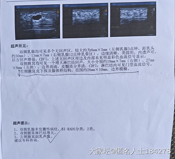 姐妹们，有懂甲状腺，乳腺，肺结节的帮看看吗？_健康