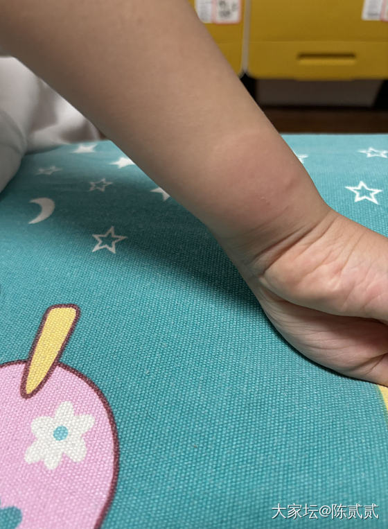 现在的蚊子这么毒了么_健康