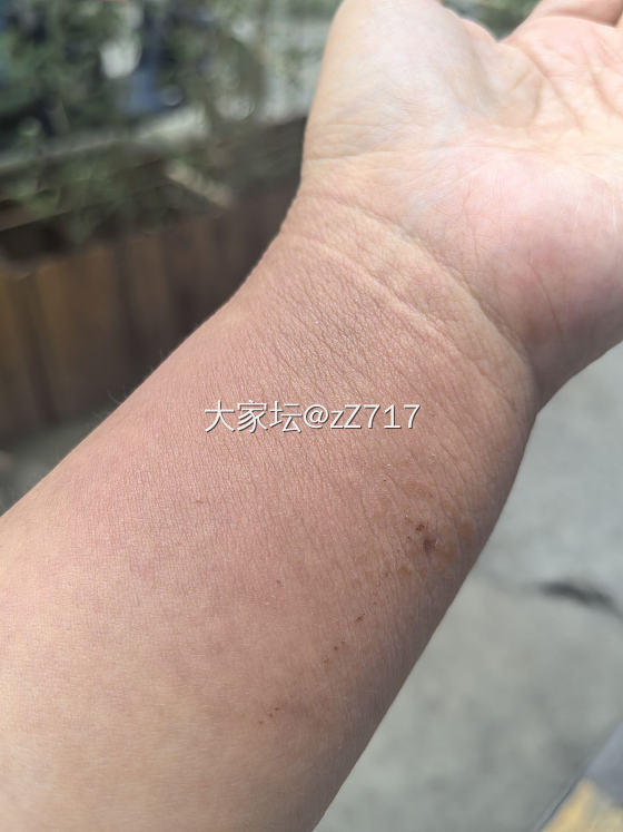 居然会对沉香过敏？！_沉香