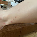 杭州的蚊子为什么这么毒？