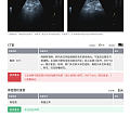 坛子里有医生老师吗？前上纵隔6*7毫米小结节怎么办呀