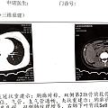 算是狠人么，断断续续疼了半个月